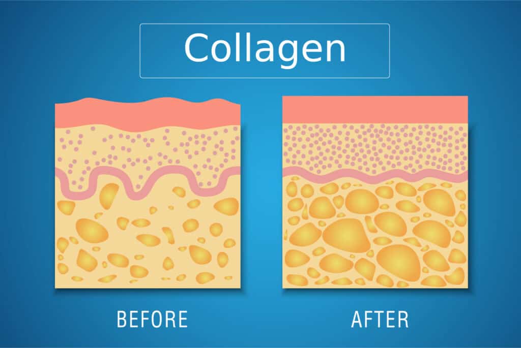 what youtheory collagen claims did we find